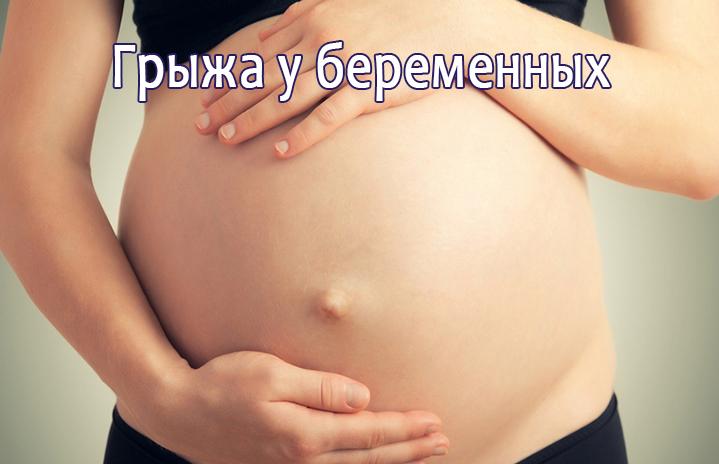 Симптомы грыжи у беременных